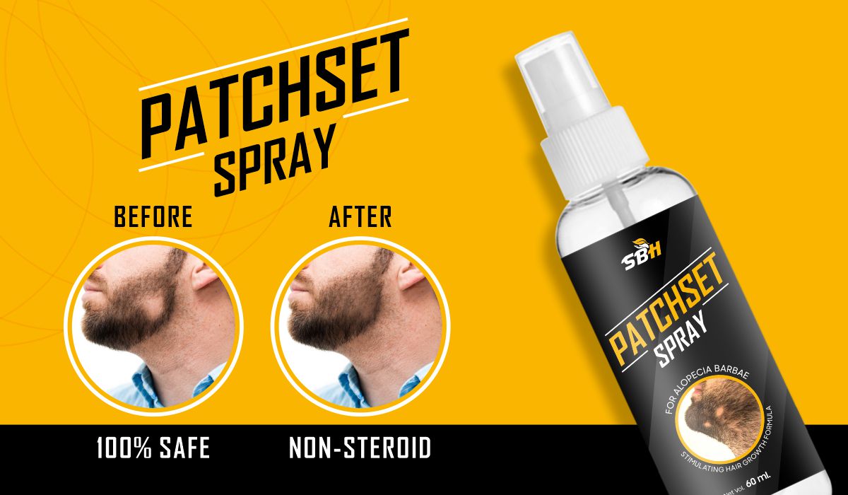 SBH Alopecia Areata spray Medicine