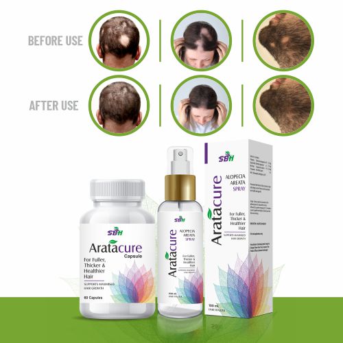 SBH Alopecia Areata spray Medicine